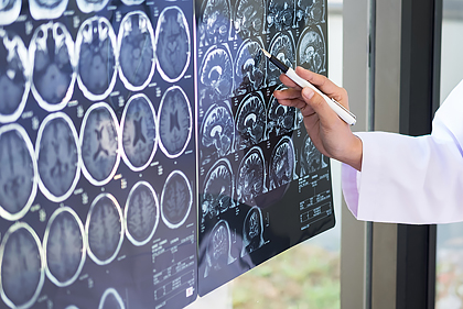 神経内科イメージ